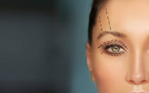 Central-Day-Surgery eyelid surgery Adelaide