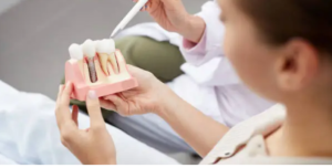 Dental Crowns Adelaide - What Are Dental Crowns?